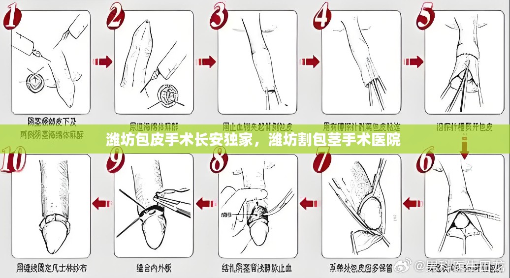 潍坊包皮手术长安独家，潍坊割包茎手术医院 