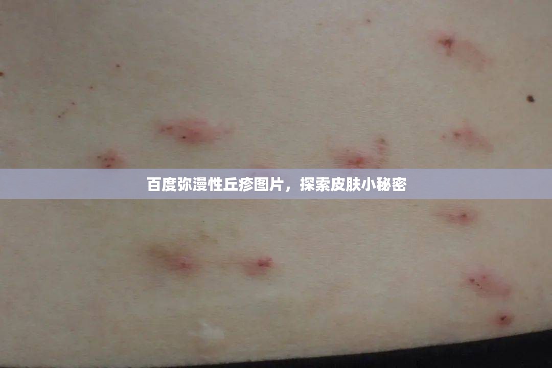 百度弥漫性丘疹图片，探索皮肤小秘密